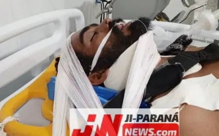 Identificado - Condutor que sofreu queda de motocicleta na zona rural de Ji-Paraná sofreu traumatismo craniano e está entubado