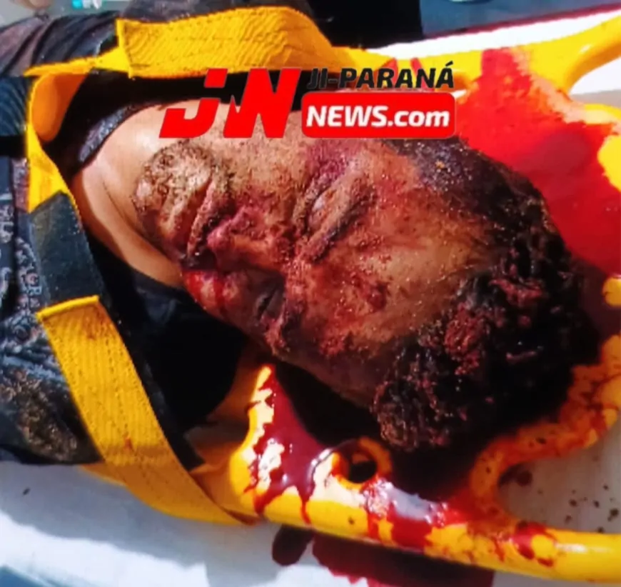 Homem é Brutalmente Espancado no Bairro Novo Ji-Paraná