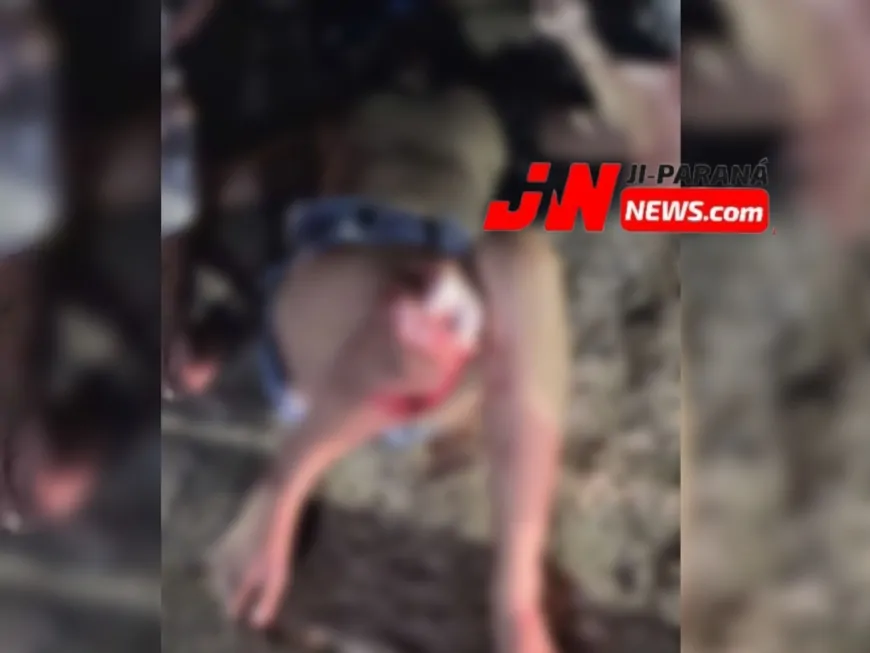 Acidente de Trânsito em Ji-Paraná Deixa Jovem em Estado Grave