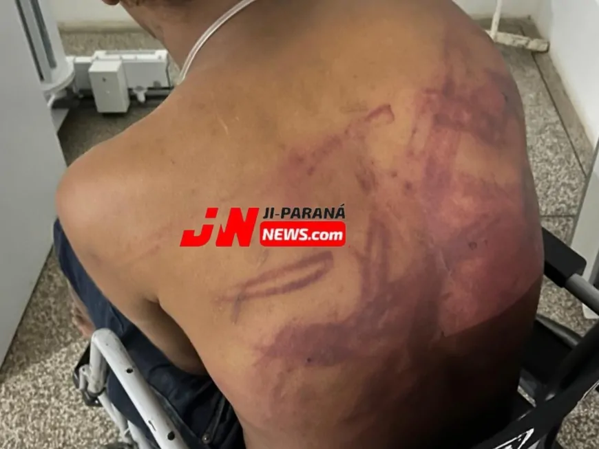 Velho conhecido da PM, homem com deficiência é agredido por justiceiro em Ji-Paraná