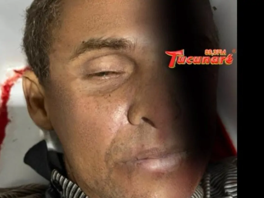 Morador de Ji-Paraná morre atropelado em Juara