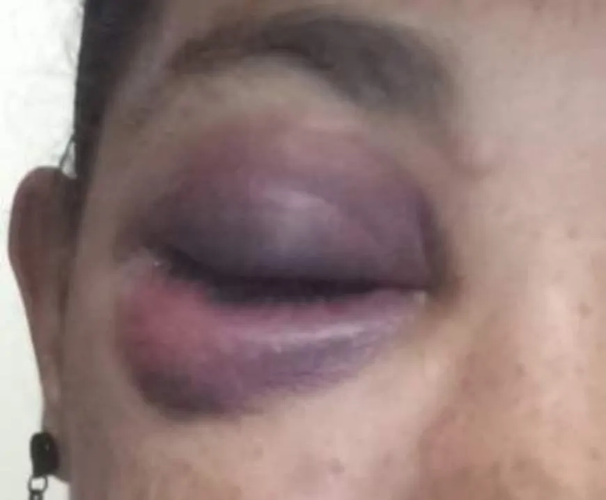 Polícia investiga agressão grave em casa de shows no Setor Chacareiro
