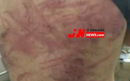 Homem é surpreendido por dupla e agredido com fio