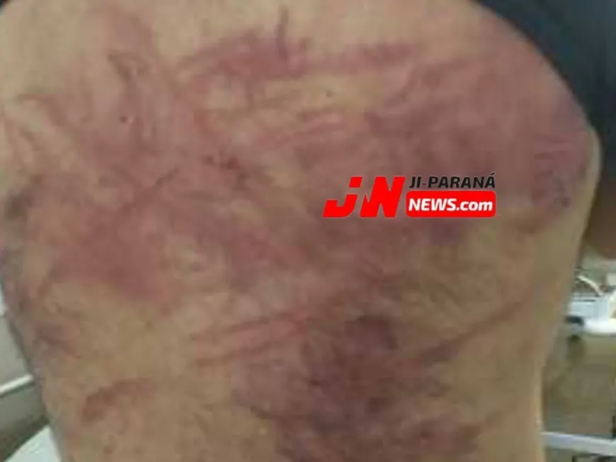 Homem é surpreendido por dupla e agredido com fio