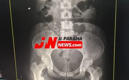 Mulher afirma ter escondido droga em órgão genital e mobiliza Polícia Militar