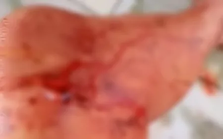 Briga com cunhado termina com homem ferido por faca em Ji-Paraná