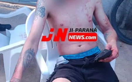 Ataque a facadas em bar mobiliza socorro e será investigado em Ji-Paraná