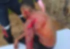 Tentativa de Homicídio mobilizado Polícia Militar, Samu e Perícia em Ji-Paraná