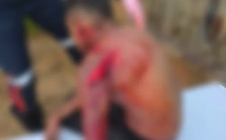 Tentativa de Homicídio mobilizado Polícia Militar, Samu e Perícia em Ji-Paraná