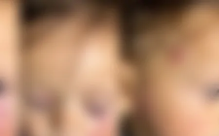 Polícia investiga origem de lesões em criança após atendimento em unidade de saúde