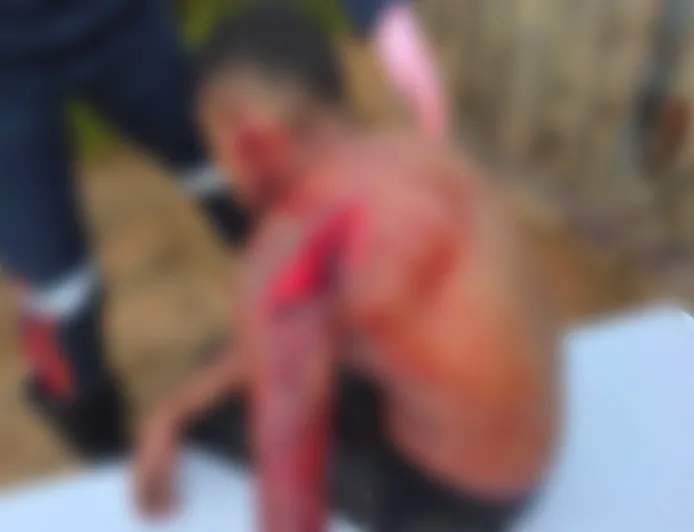 Tentativa de Homicídio mobilizado Polícia Militar, Samu e Perícia em Ji-Paraná