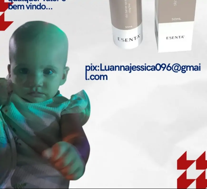 Família faz apelo por ajuda para bebê com condição rara que precisa de pomada especial