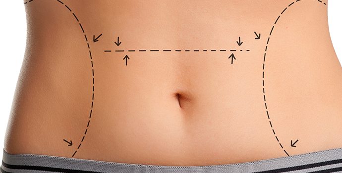 Alimentos que ajudam perder peso e gordura localizada