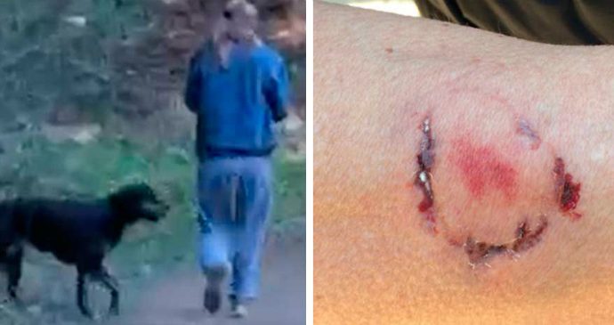 Corredora foi mordida por dona de cachorro durante treino