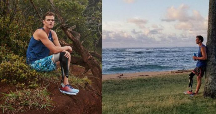 Surfista perde perna em ataque de tubarão e se apaixona pela corrida