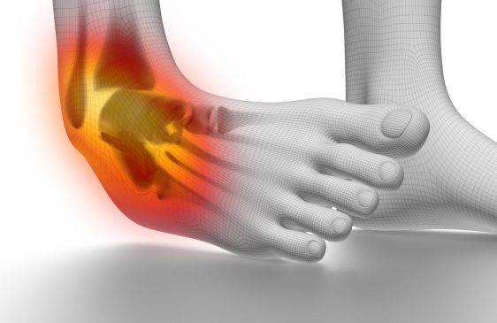 Ligamentos do tornozelo: como evitar e tratar as lesões na região