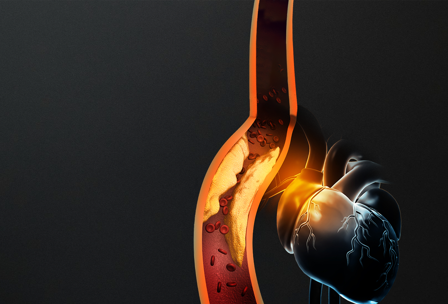 Cardiometabolismo e Aterosclerose: Interfaces e Novas Perspectivas