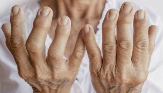 paciente en tratamiento médico por dolor articular