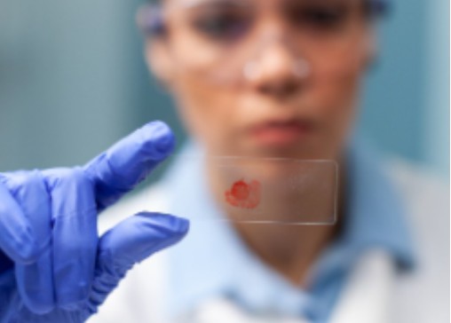 vidacel-banco-familiar-celulas-madre.