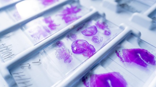 beneficios de contar con un laboratorio propio de células madre para tu guagua